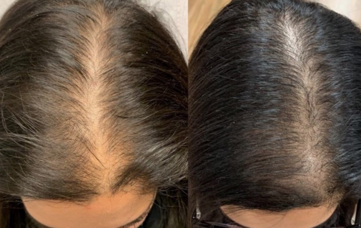 Before &After
